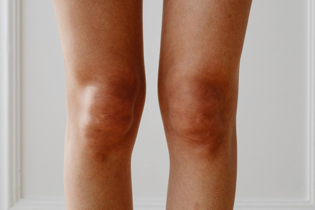 The Oestrogen And Collagen Question. Why The Same Program Can Feel Like Two Different Programs Across One Month.
